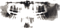 [Teeth]